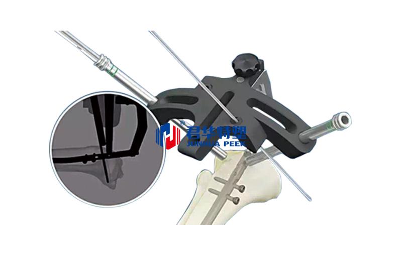 Suporte de barra de PEEK para cirurgia de haste intramedular